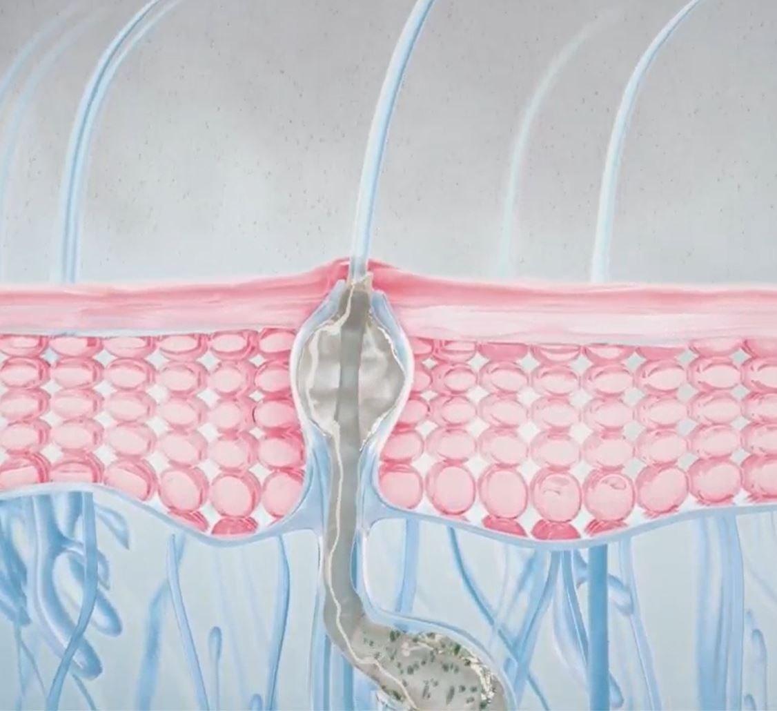 Image du brevet Fluidactiv